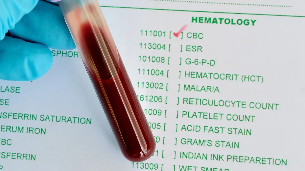What is Hct Auto in Blood Test